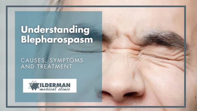 Understanding Blepharospasm: Causes, Symptoms and Treatment